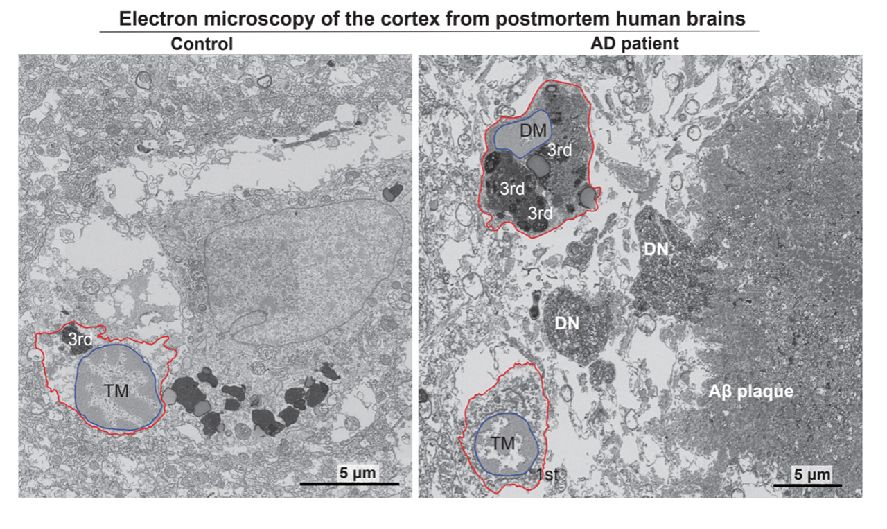 A photo of an electron micrographs