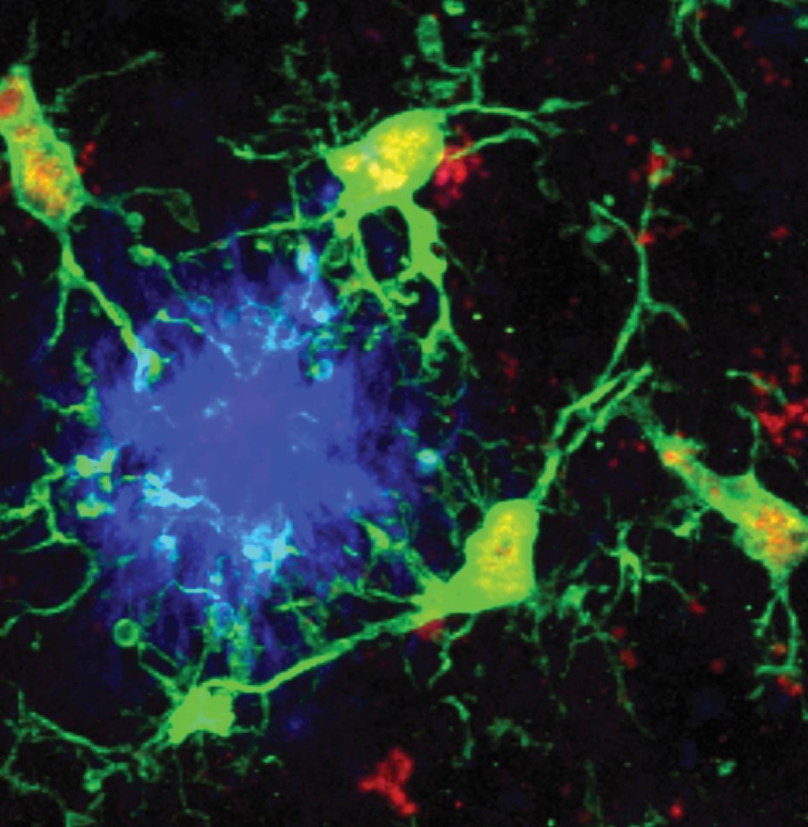 Colorful depiction of neurons, with a central blue area surrounded by green and yellow structures on a dark background.
